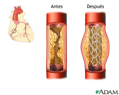 Cuidados postoperatorios (primera parte)
