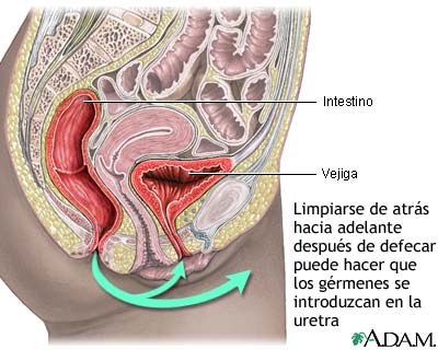 Prevenci&oacute;n de la cistitis