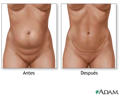 Cuidados postoperatorios