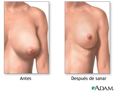 Cuidados postoperatorios