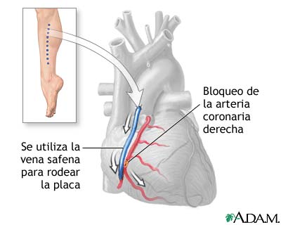 Procedimiento (segunda parte)