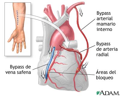 Procedimiento (tercera parte)