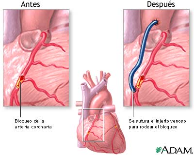Cuidados postoperatorios