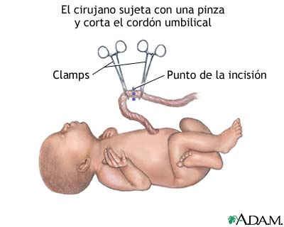 Procedimiento (sexta parte)