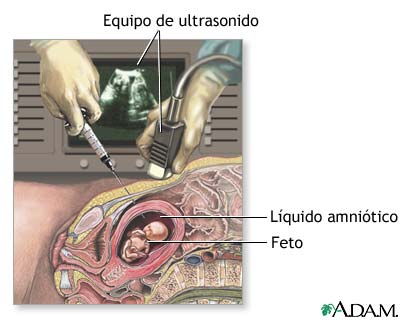 Procedimiento (primera parte)