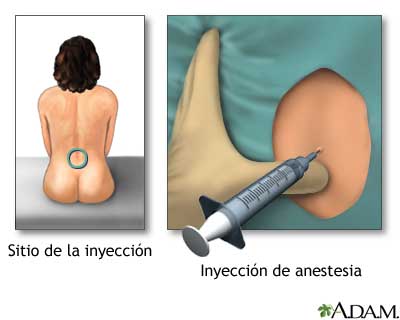 Procedimiento (tercera parte)