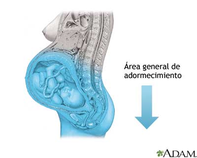 Procedimiento (sexta parte)