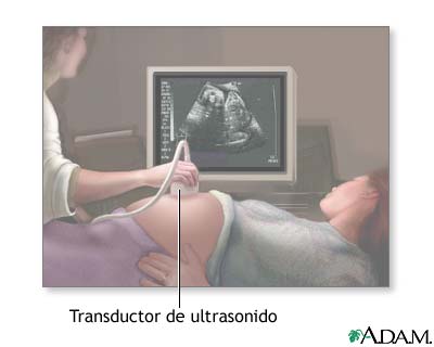 Procedimiento (primera parte)