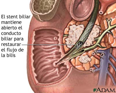 Cuidados postoperatorios