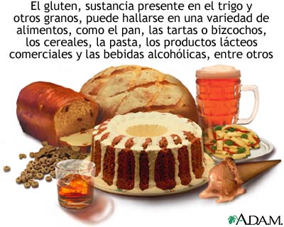 Espr&uacute;e cel&iacute;aco; alimentos que se deben evitar