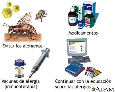 Introducci&oacute;n al tratamiento de las alergias