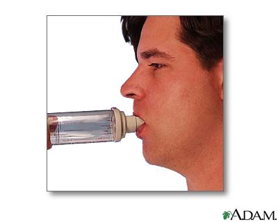 Uso del espaciador (Cuarta parte)