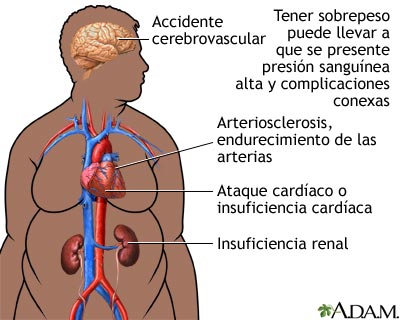 Obesidad y salud