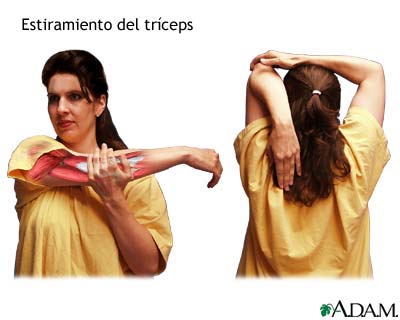 Estiramiento del tr&iacute;ceps