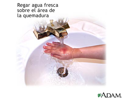 Procedimiento, parte 1