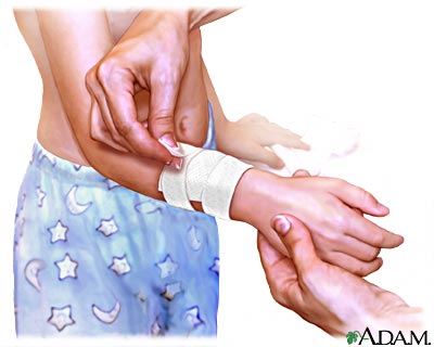 Procedimiento, parte 4