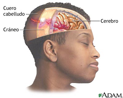 Lesi&oacute;n en la cabeza