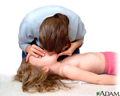 Ni&ntilde;o que no respira