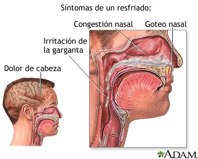 S&iacute;ntomas del resfriado