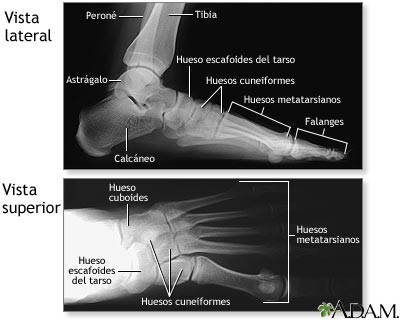 Radiograf&iacute;a del pie normal