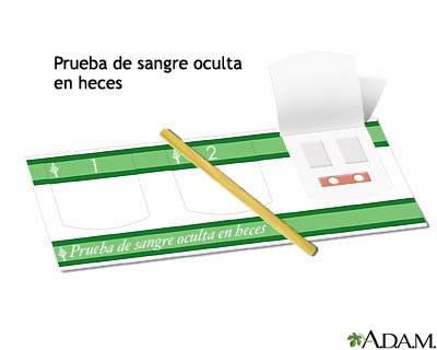 Prueba de sangre oculta en heces