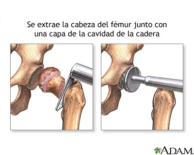 Procedimiento (primera parte)