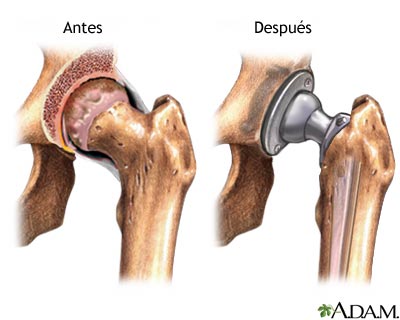 Cuidados postoperatorios