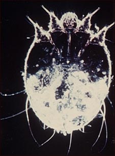 Microfotograf&iacute;a del &aacute;caro de la escabiosis