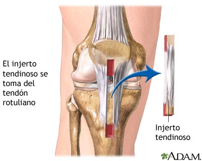 Procedimiento: 1a parte