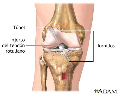 Procedimiento: 2a parte