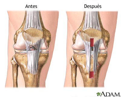 Cuidados posoperatorios