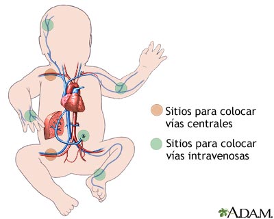 Sitios para administrar l&iacute;quidos intravenosos