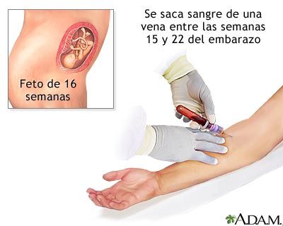 Prueba cu&aacute;druple