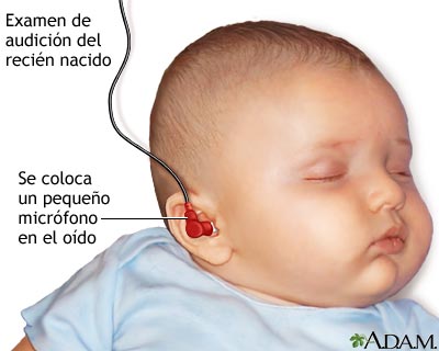 Examen de audici&oacute;n