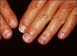 U&ntilde;as mitad y mitad