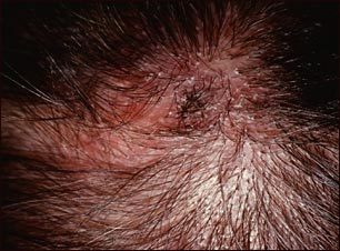 Ti&ntilde;a de la cabeza vista de cerca