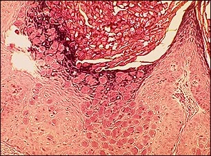 Molusco,aspecto microsc&oacute;pico