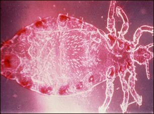 Piojo macho de la cabeza