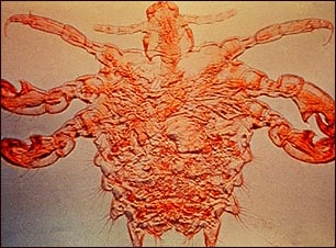 Piojo macho del pubis