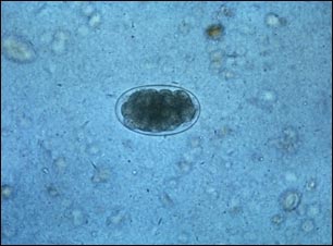 Huevo de anquilostoma