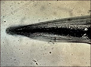 Lombriz intestinal: primer plano de la cabeza