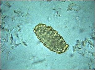 Huevo de Ascaris lumbricoides
