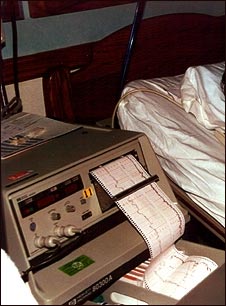 Monitor card&iacute;aco fetal y de contracci&oacute;n uterina