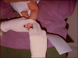 Examen de fenilcetonuria