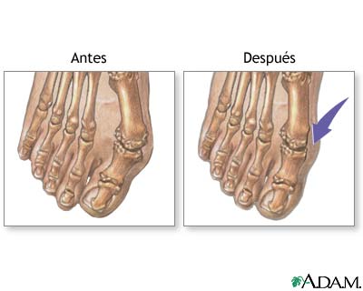 Cuidados postoperatorios