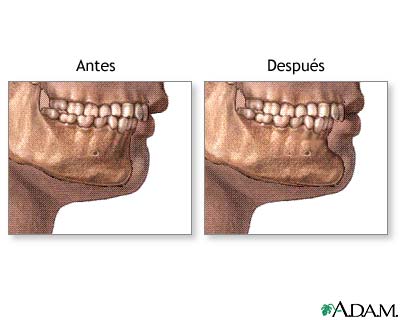 Cuidados postoperatorios