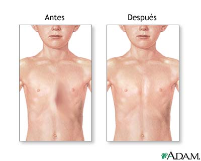 Cuidados postoperatorios