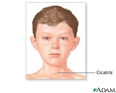 Cuidados postoperatorios