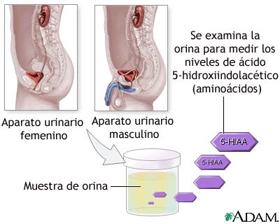 Prueba de aminoaciduria en orina