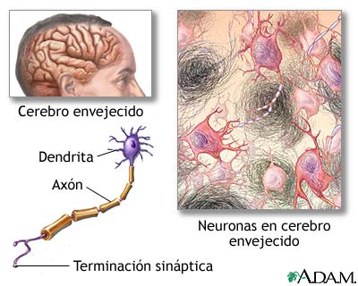 Tejido nervioso envejecido